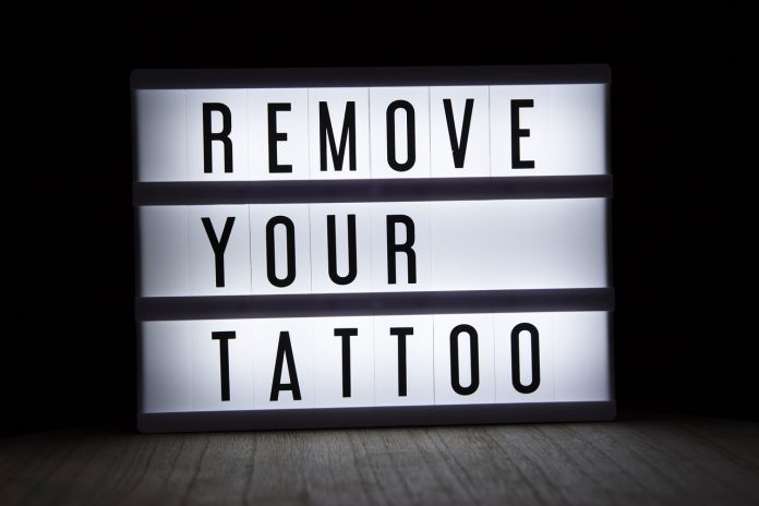 rimozione dei tatuaggi